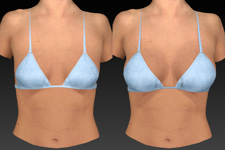 breast sculptor blue animation large1 1 1