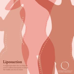American Society of Plastic Surgeons liposuction marketing image