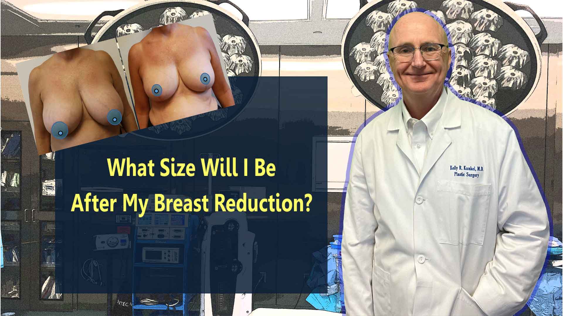 Thumbnail image of Dr. Kunkel's "What Size Will I Be After My Breast Reduction" video