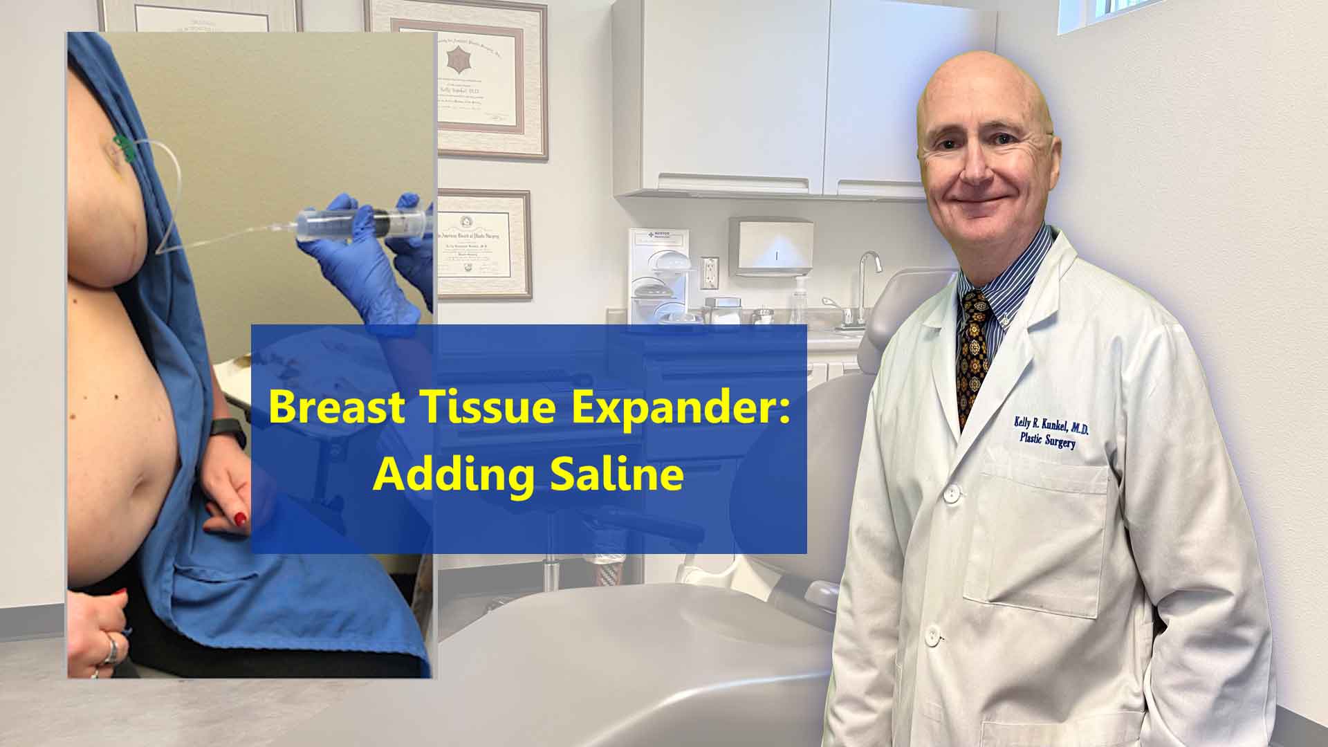 Image of Dr. Kunkel and a patient who is having saline added to her breast tissue expander