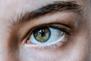 Eyelid Surgery Myths
