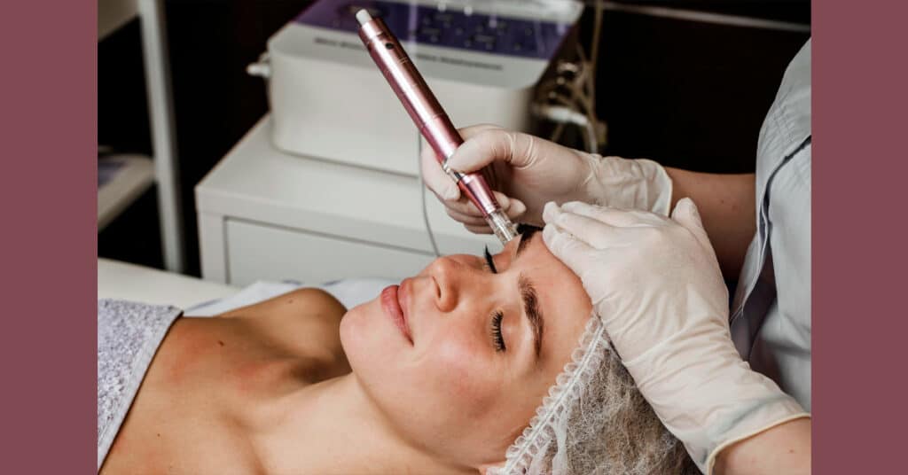 Image of a woman receiving a microneedling treatment