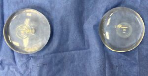 Photograph of saline breast implants removed during surgery in Fort Worth Texas