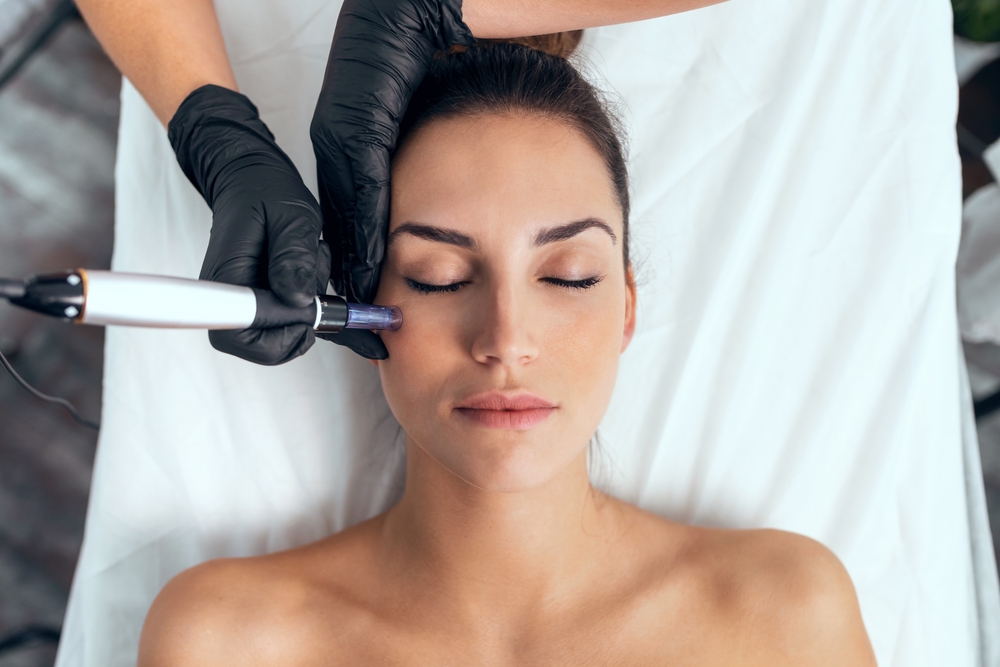 Woman undergoes microneedling treatment to improve the texture of her skin for a rejuvenated appearance.