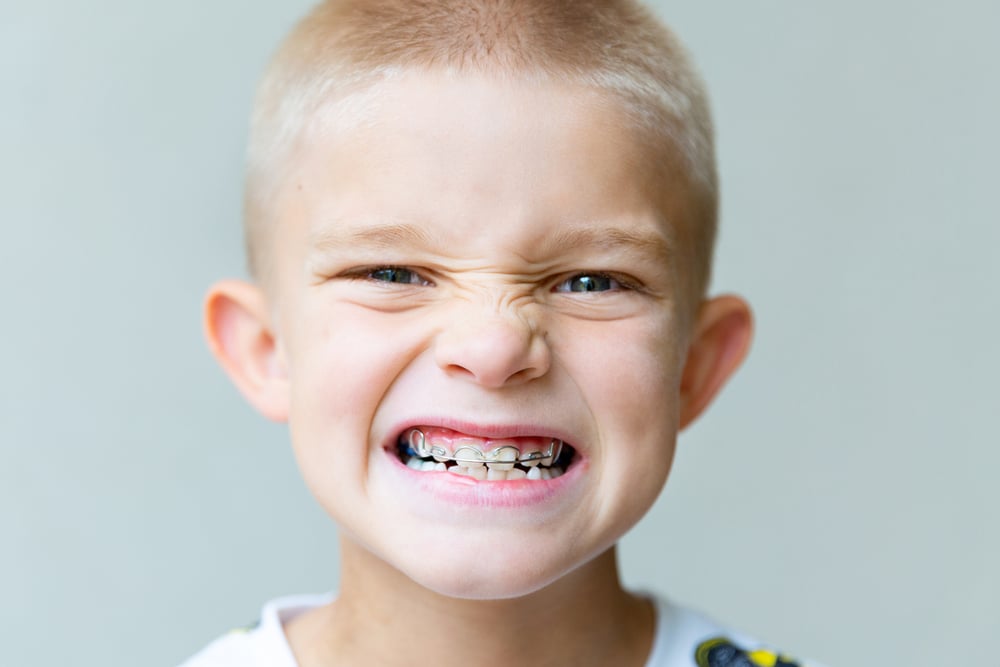 Young kid with blond hair and braces has protruding ears.
