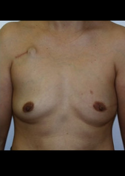 After Image