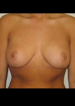 After Image
