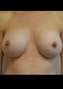 After Image