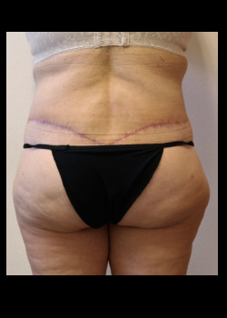 After Image