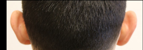 Before Image