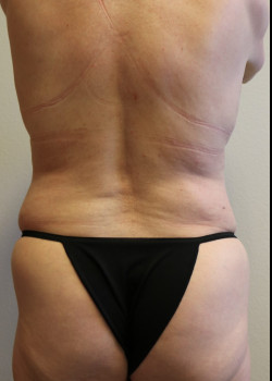 After Image